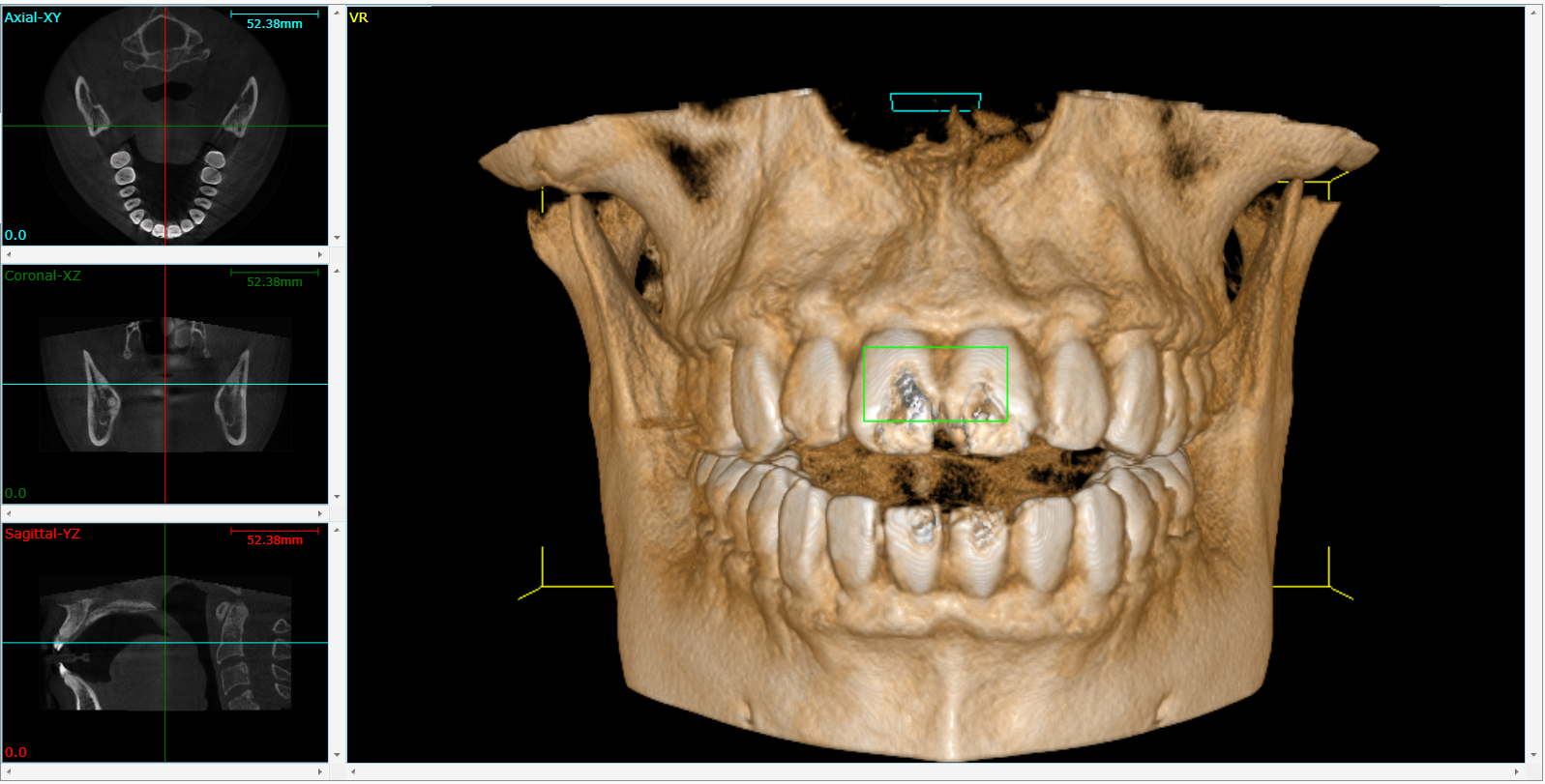 Cone Beam 3D Imaging  Phoenix, AZ